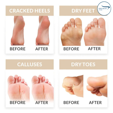 Electric Vacuum Foot Grinder - (IMPORTED)